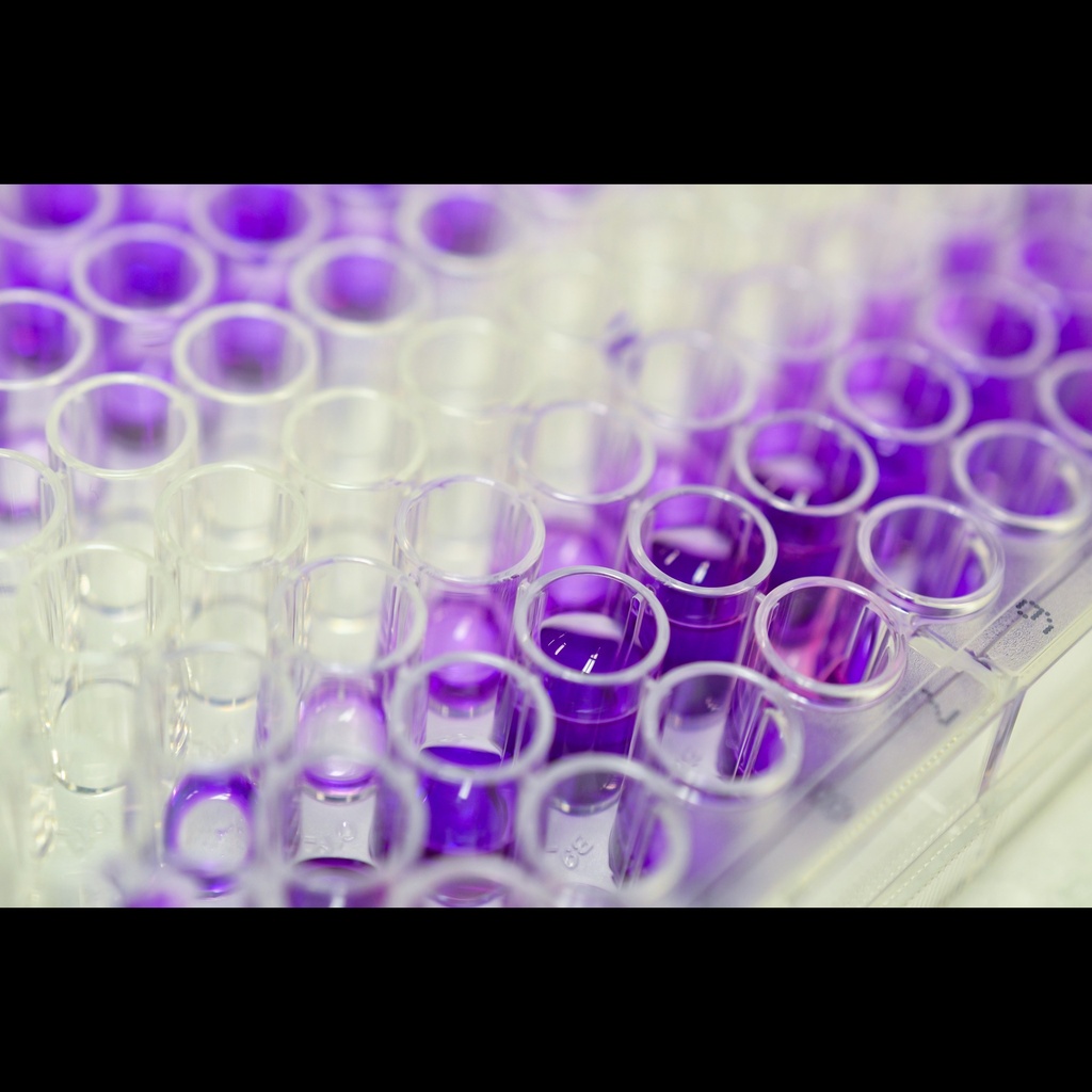 Mouse folliclesize:stimulating hormone,FSH ELISA Kitsize:96T
